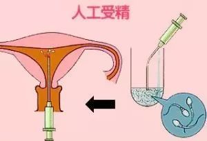 顺产后下面松弛