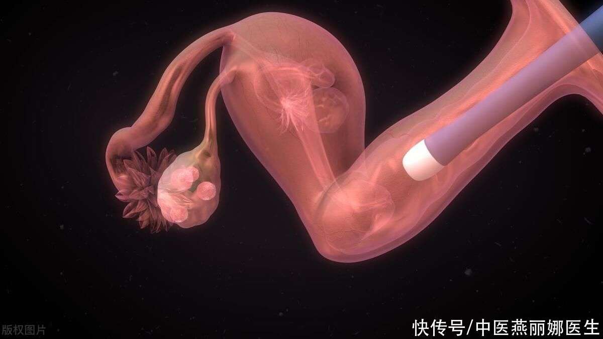 集体大产权房