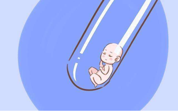 陈旧性异位妊娠