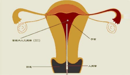 雄性不育保持系