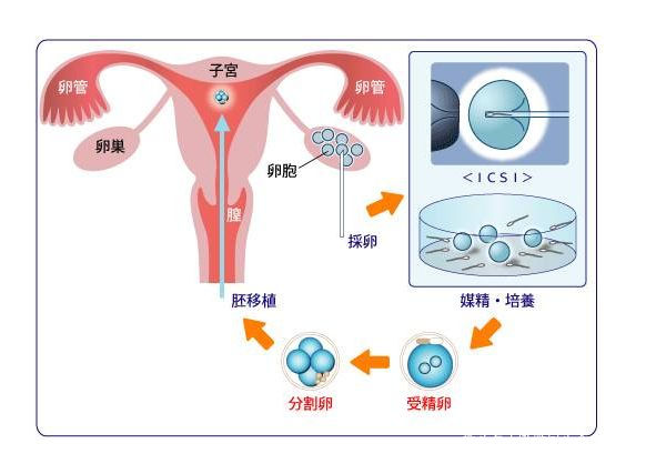 顺产妈妈