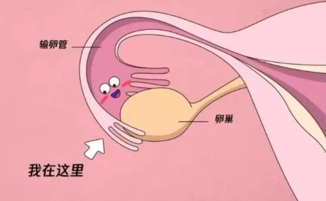 闺蜜生孩子