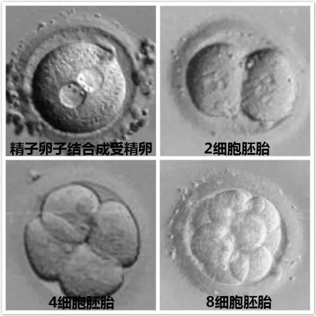 顺产恶露