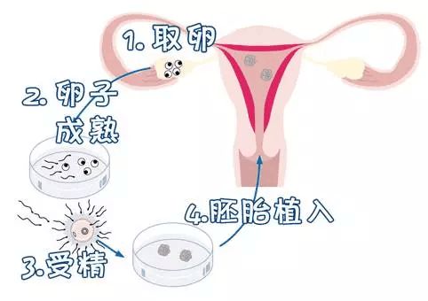 降低血糖