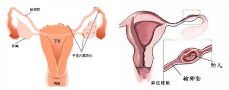 青春期