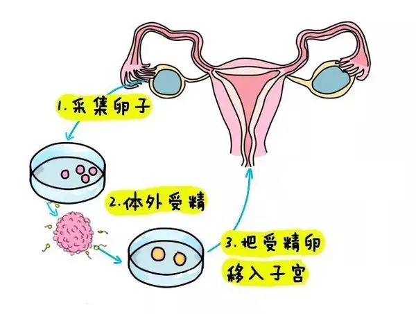 阴超