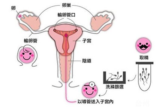 顺产