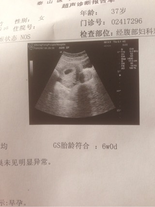 顺产