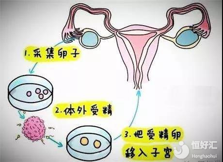 顺产妈妈