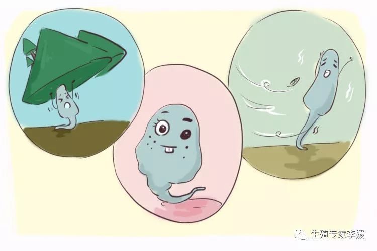 顺产