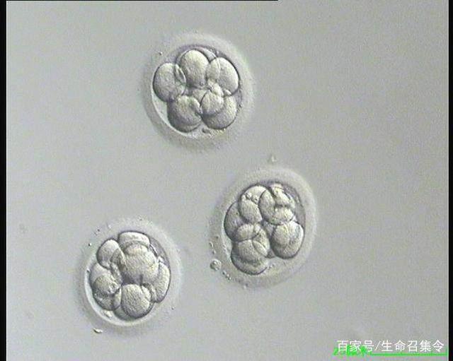 石家庄试管婴儿