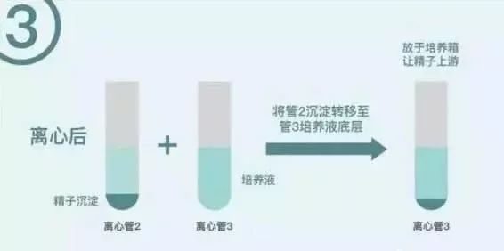 郑州试管婴儿费用明细